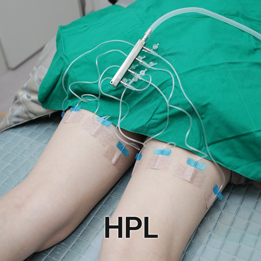 hpl