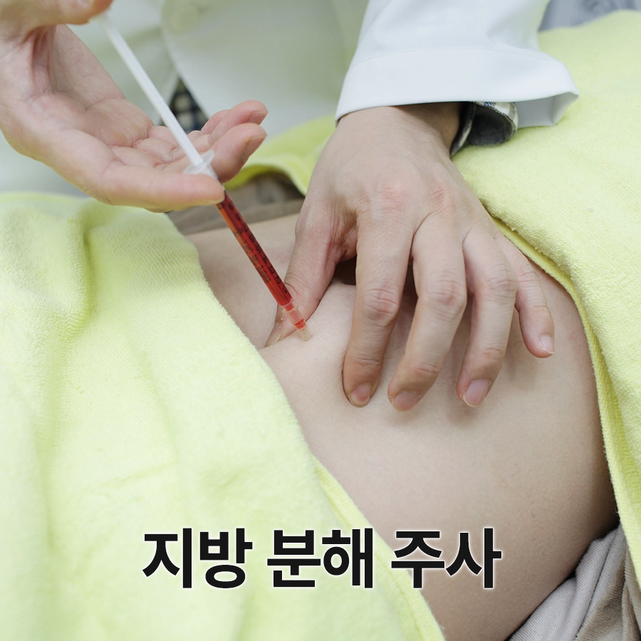 지방분해주사