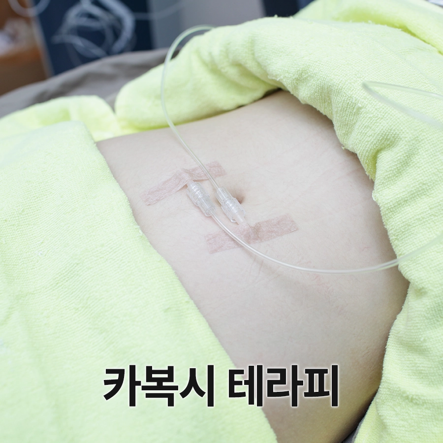 카복시